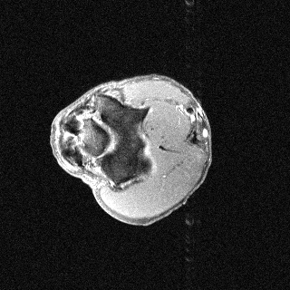 Axial sample