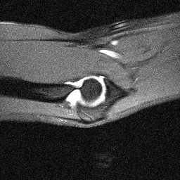 Sagittal sample